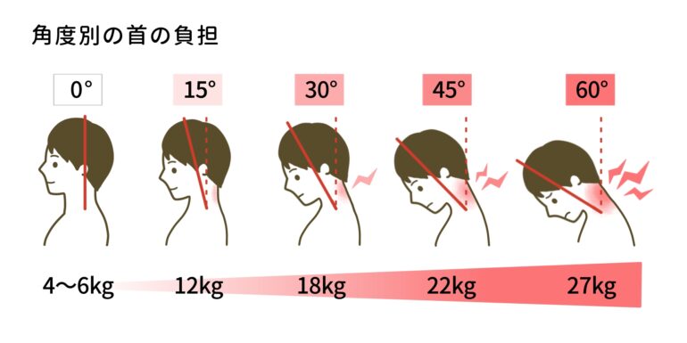 角度別の首への負担